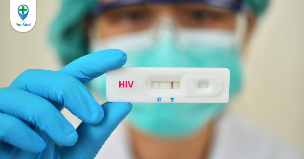 Xét nghiệm HIV: thời điểm, quy trình và cách đọc kết quả