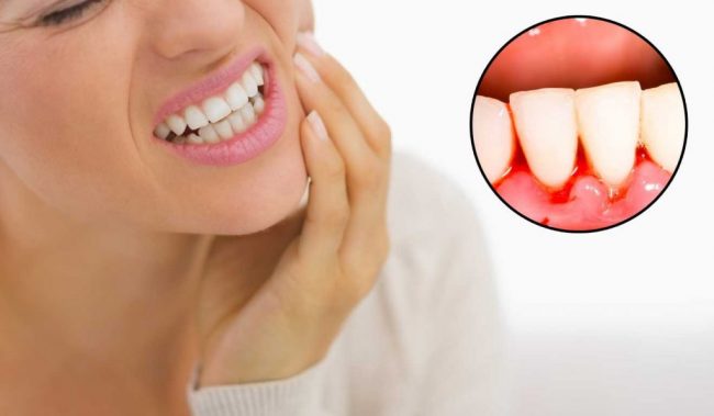 Chảy máu chân răng: Cơ thể bạn đang muốn báo động điều gì?