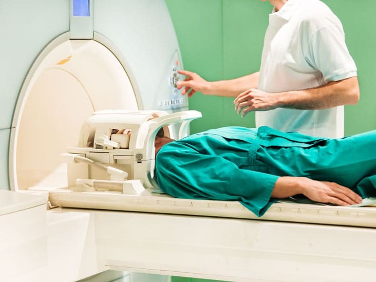 Chụp cộng hưởng từ sọ não (MRI) trong chẩn đoán rối loạn tiền đình