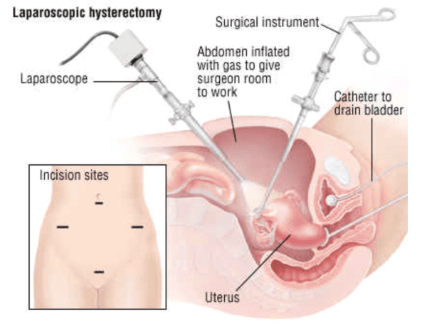 Một trong những dạng của phẫu thuật xâm lấn tối thiểu là sử dụng dụng cụ “scope”