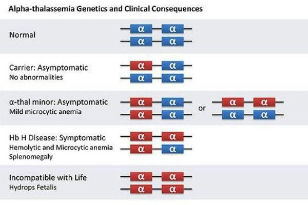 Minh hoạ các kiểu hình gen của α - thalassemia