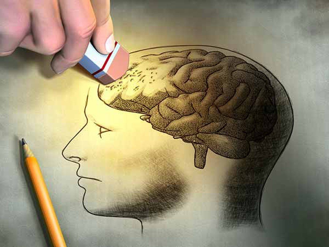 Bệnh ALZHEIMER 1