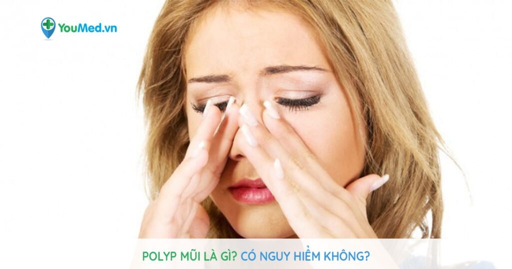 Polyp mũi là gì? Nguyên nhân, triệu chứng và cách điều trị