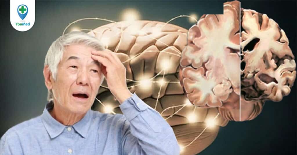 Đãng trí ở người lớn tuổi: Có phải do mắc bệnh Alzheimer?