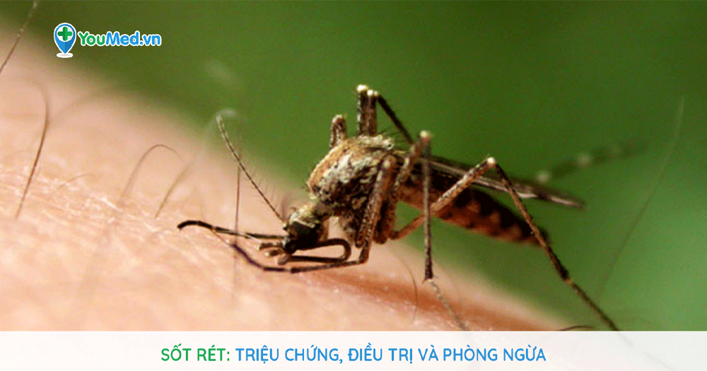Sốt rét: Triệu chứng, điều trị và phòng ngừa