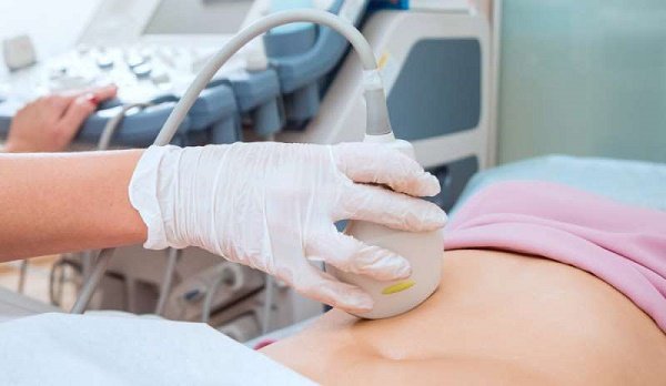 Chẩn đoán ung thư buồng trứng