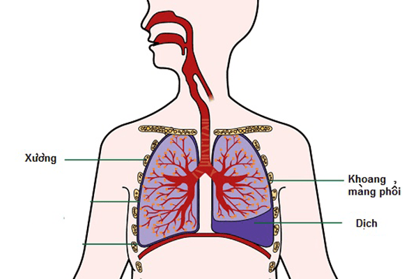Khoang màng phổi