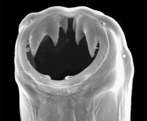 Đầu giun móc dưới kính hiển vi điện tử