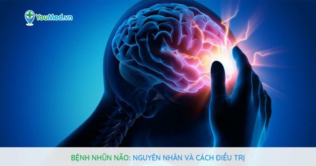 Bệnh nhũn não: Nguyên nhân và cách điều trị