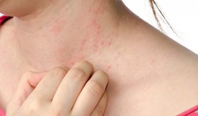 Tác dụng phụ của Gastropulgite
