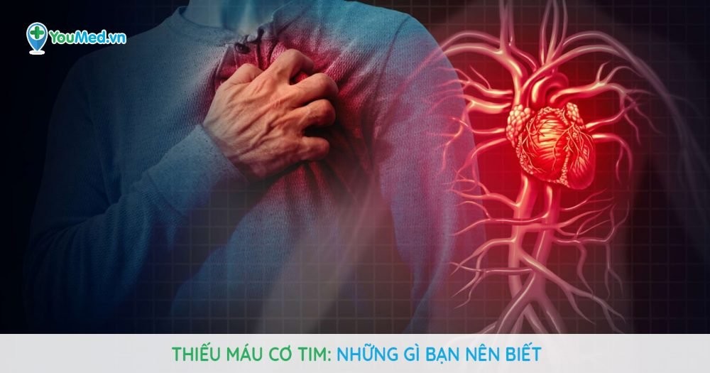 Thiếu máu cơ tim: Nguyên nhân, dấu hiệu và cách điều trị