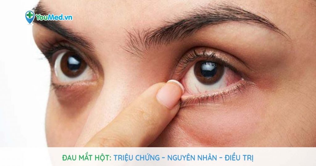 Đau mắt hột: Triệu chứng, nguyên nhân và cách điều trị