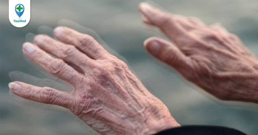 Bệnh Parkinson có thể chữa khỏi hoàn toàn không?
