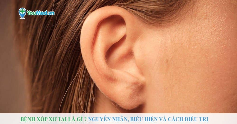 Bệnh xốp xơ tai là gì?  Nguyên nhân, biểu hiện và cách điều trị