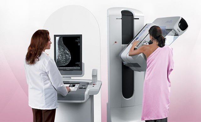 Chụp X- quang tuyến vú