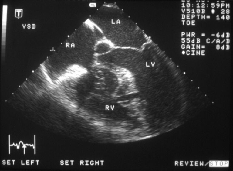 Siêu âm tim và chụp X-quang ngực để kiểm tra tim cho trẻ.