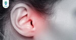 Viêm tai giữa ở trẻ