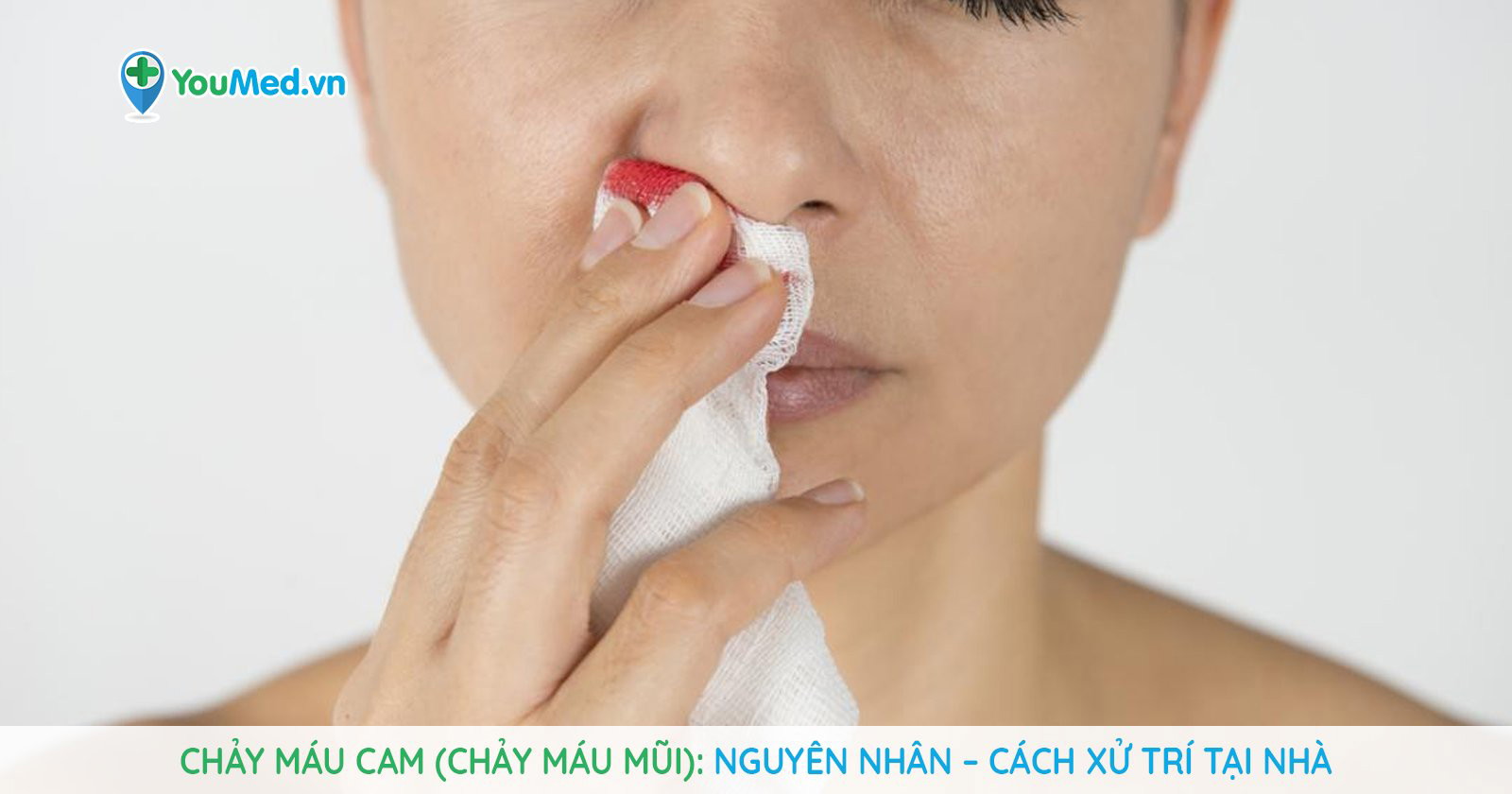 Chảy Máu Cam Chảy Máu Mũi Nguyên Nhân Cách Xử Trí Tại Nhà Youmed