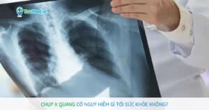 Chụp X quang có nguy hiểm gì tới sức khỏe không?