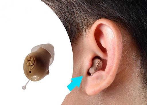 Máy trợ thính là gì : Khi nào cần đeo máy trợ thính?