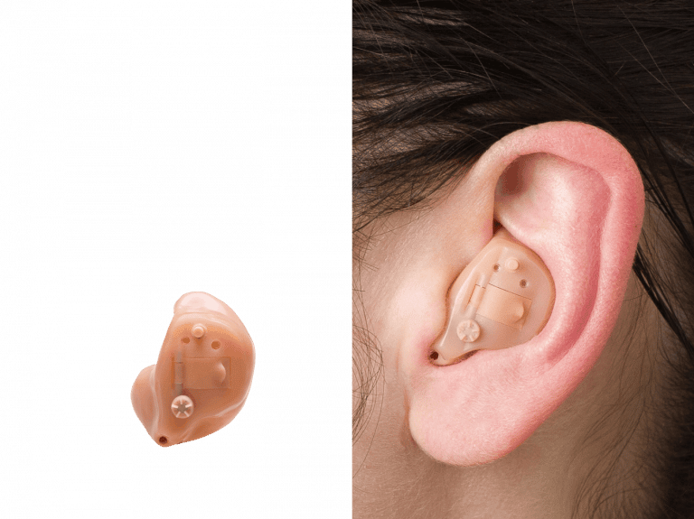 Máy trợ thính là gì : Khi nào cần đeo máy trợ thính?
