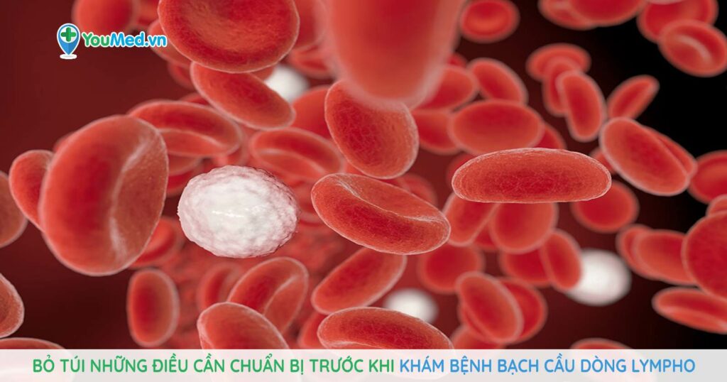Bỏ túi những điều cần chuẩn bị trước khi đi khám bệnh bạch cầu cấp dòng lympho