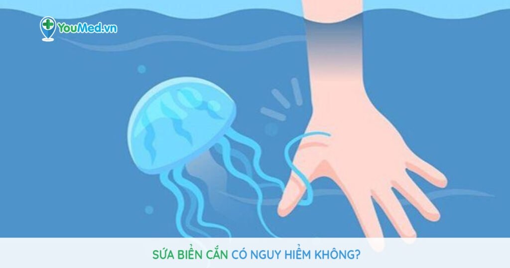 Sứa biển cắn có nguy hiểm không?