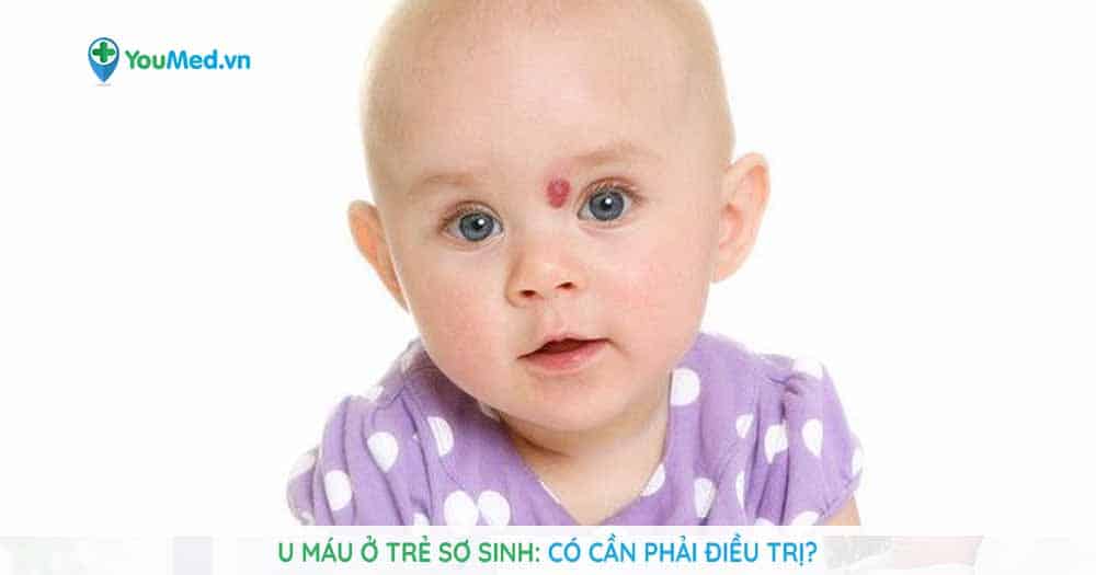 U máu ở trẻ sơ sinh: Liệu có cần điều trị?