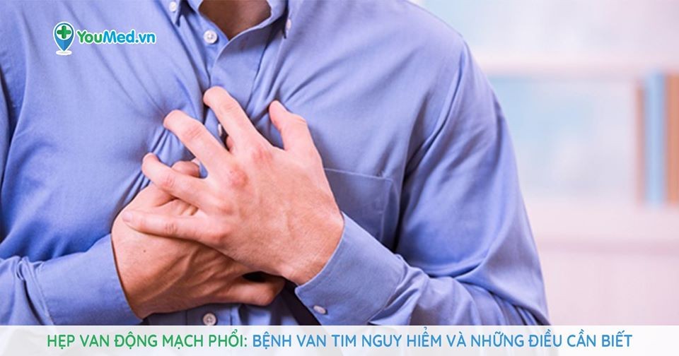 Hẹp van động mạch phổi: Bệnh van tim nguy hiểm và những điều cần biết