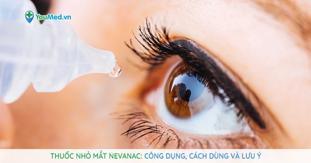Những điều cần biết về thuốc nhỏ mắt Nevanac