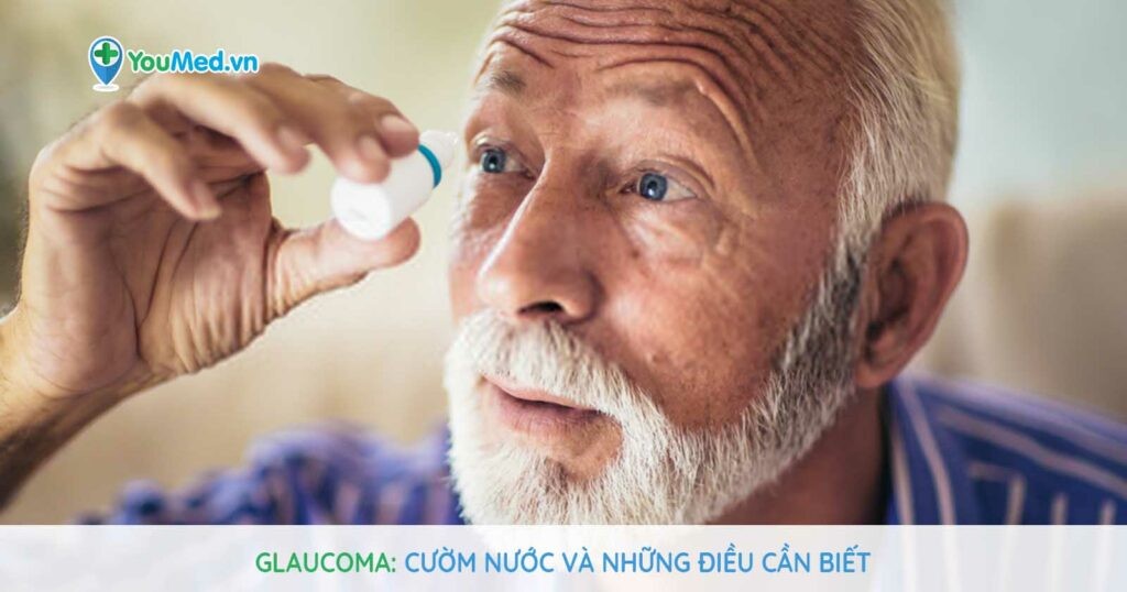 Glaucoma: Bệnh cườm nước và những điều cần biết