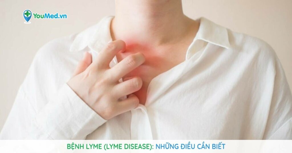 Bệnh Lyme (Lyme Disease): Bạn đã biết gì?