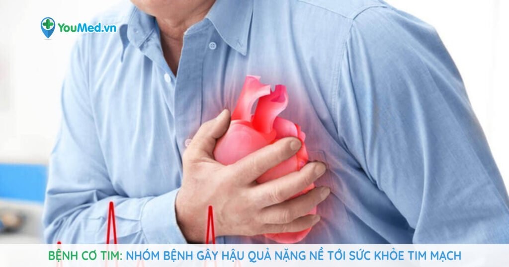 Bệnh cơ tim: Nhóm bệnh gây hậu quả nặng nề tới sức khỏe tim mạch