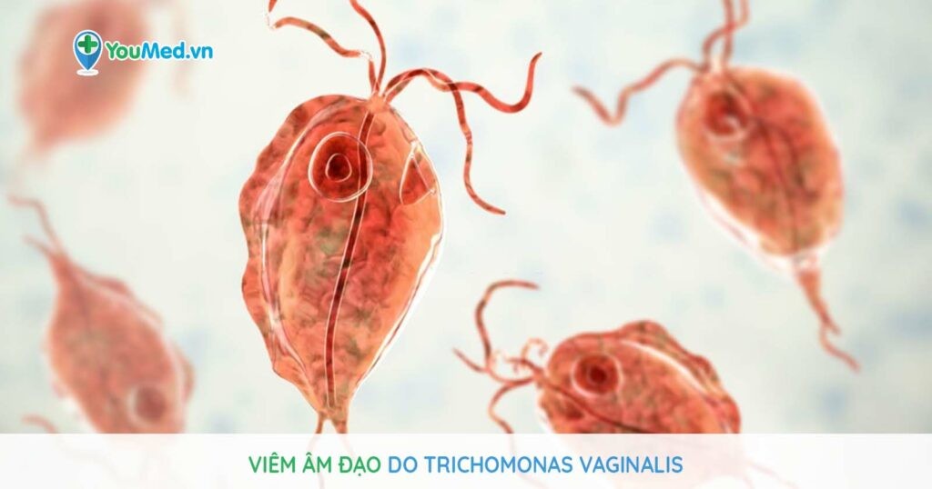 Viêm âm đạo do Trichomonas vaginalis