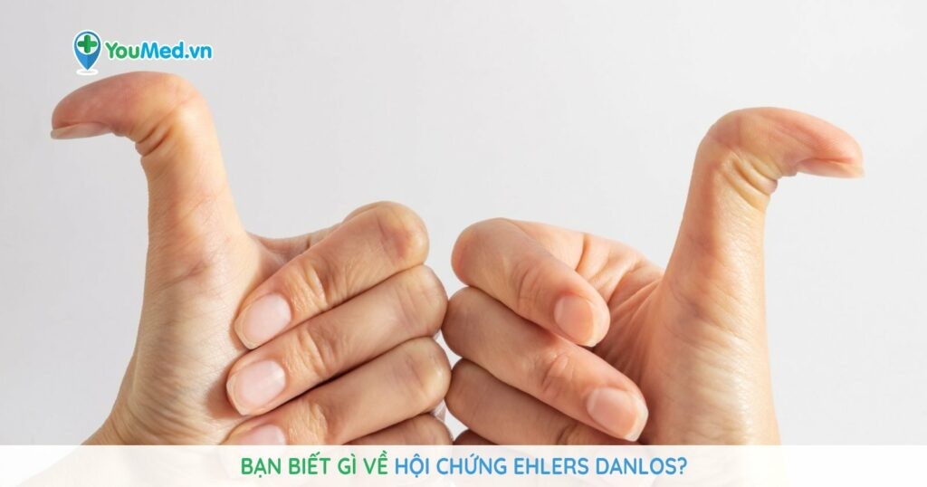 Bạn biết gì về Hội chứng Ehlers Danlos?
