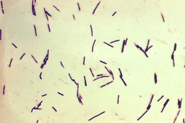 Hình ảnh Clostridium perfingens trên kính hiển vi đã được nhuộm.