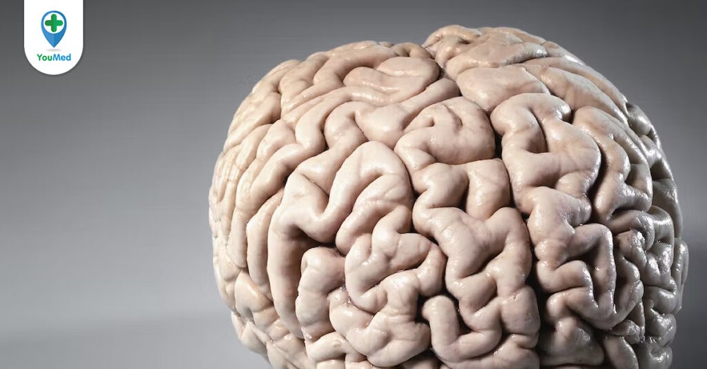U màng não thất có thể điều trị được hay không?
