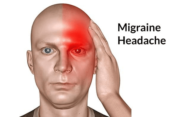 Migraine thường được biết đến với cái tên: Đau nửa đầu phức tạp