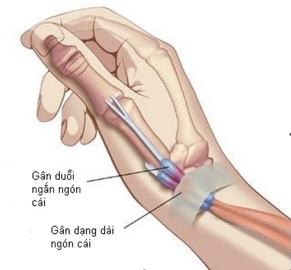Minh họa gân duỗi ngón cái ngắn và gân dạng dài ngón cái