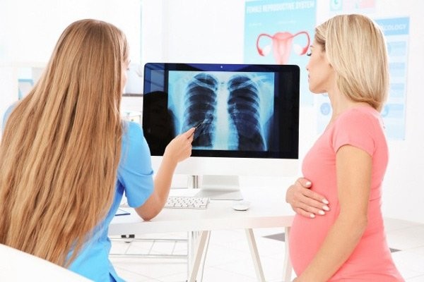 Nếu cần chụp X quang, mẹ hãy cho bác sĩ biết rằng mình đang hoặc nghi ngờ có mang thai