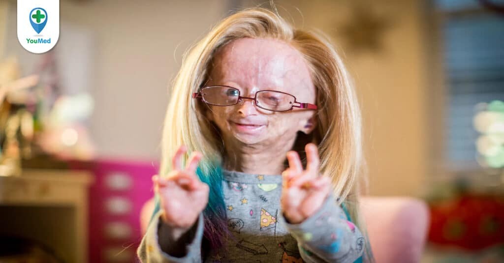 Hội chứng Progeria: Giải mã bí ẩn của những đứa trẻ già sớm