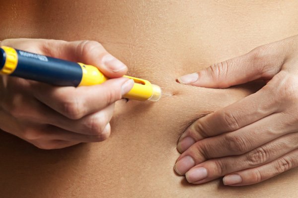 Sử dụng hCG khi kích thích buồng trứng có thể dẫn đến quá kích buồng trứng