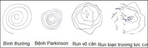 Chú thích: Các kiểu run khi được yêu cầu vẽ vòng trong xoắn ốc
