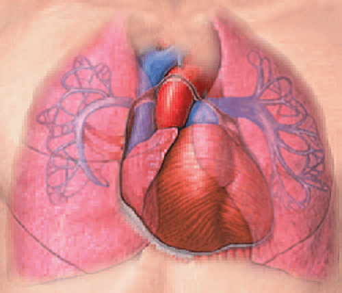 Động mạch phổi bị hẹp lại, kích thước tim phải lớn hơn 