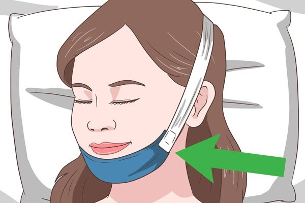 Dùng băng cằm đầu cho bệnh nhân thở miệng