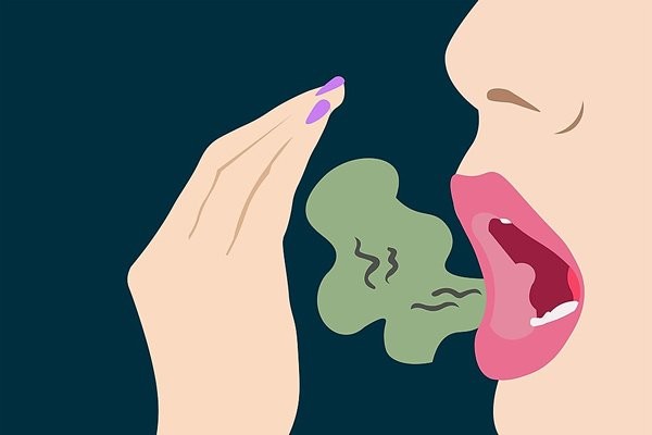 Thở bằng miệng có thể gây mùi hôi cho miệng