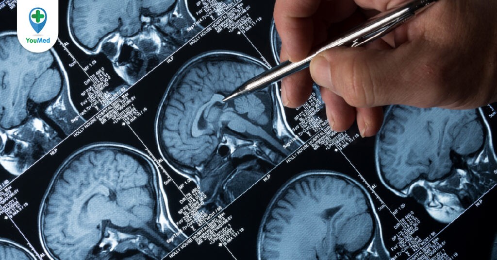 U não: Nguyên nhân, triệu chứng và cách điều trị