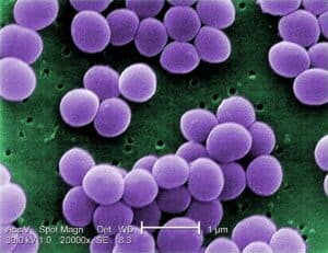 Hình ảnh mình họa vi khuẩn Staphylococcus aureus.