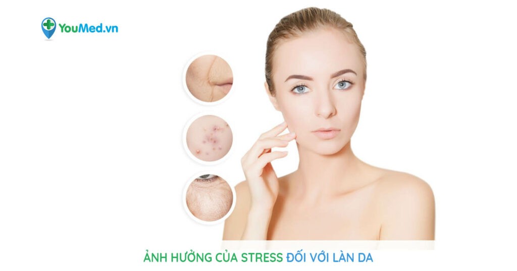 Ảnh hưởng của stress đối với làn da