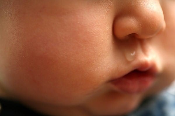 Hình 1: Chảy mũi nước trong là dấu hiệu đầu tiên gợi ý cảm lạnh ở trẻ sơ sinh.